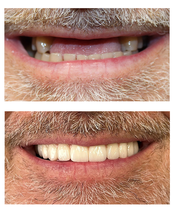 Before & After Gallery