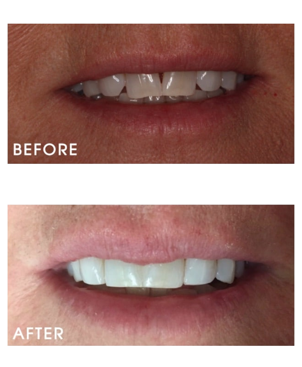 Before & After Gallery