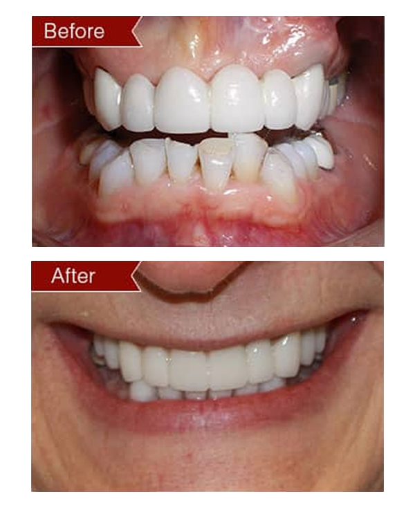 Before & After Gallery