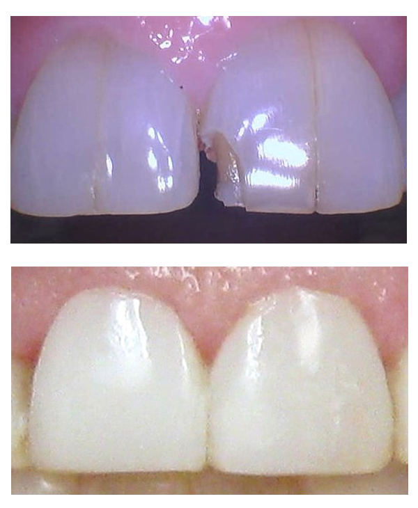 Before & After Gallery