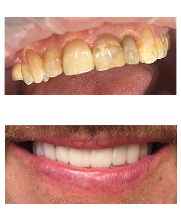 Before & After Gallery