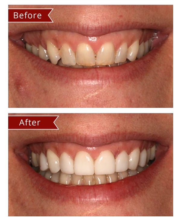 Before & After Gallery