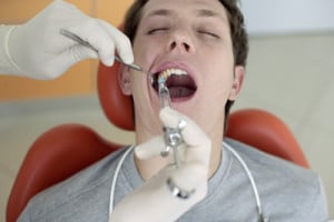 wisdom teeth dentist