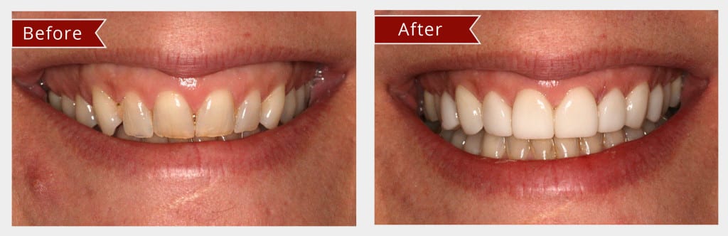 1763526164_Lumineers-Results-02-1024x332