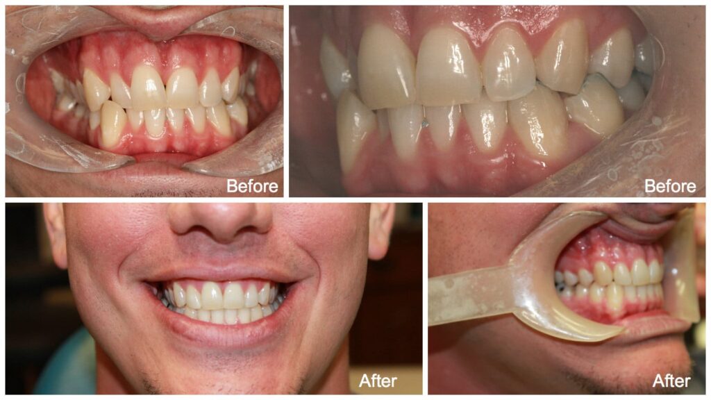 1763526384_Clear_Correct_Results