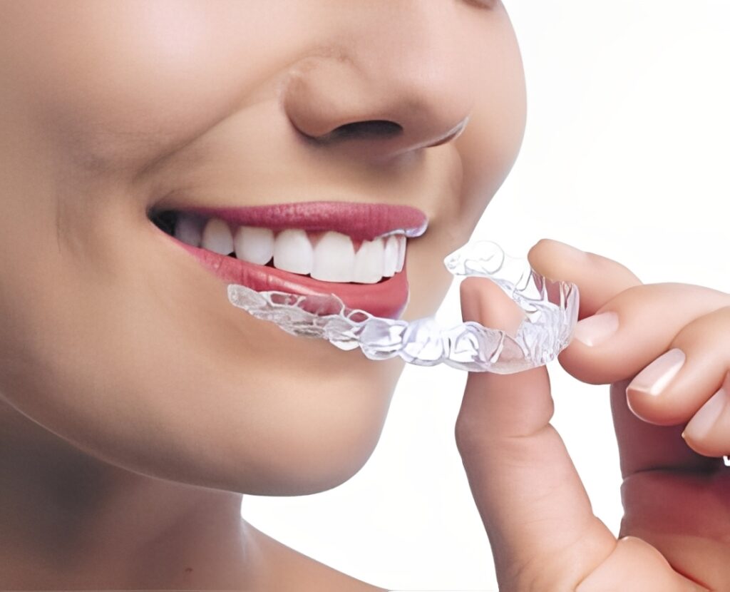Orthodontics-New-Fairfield