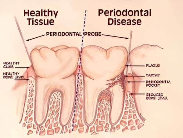 Periodontist-Fairfield-County-2