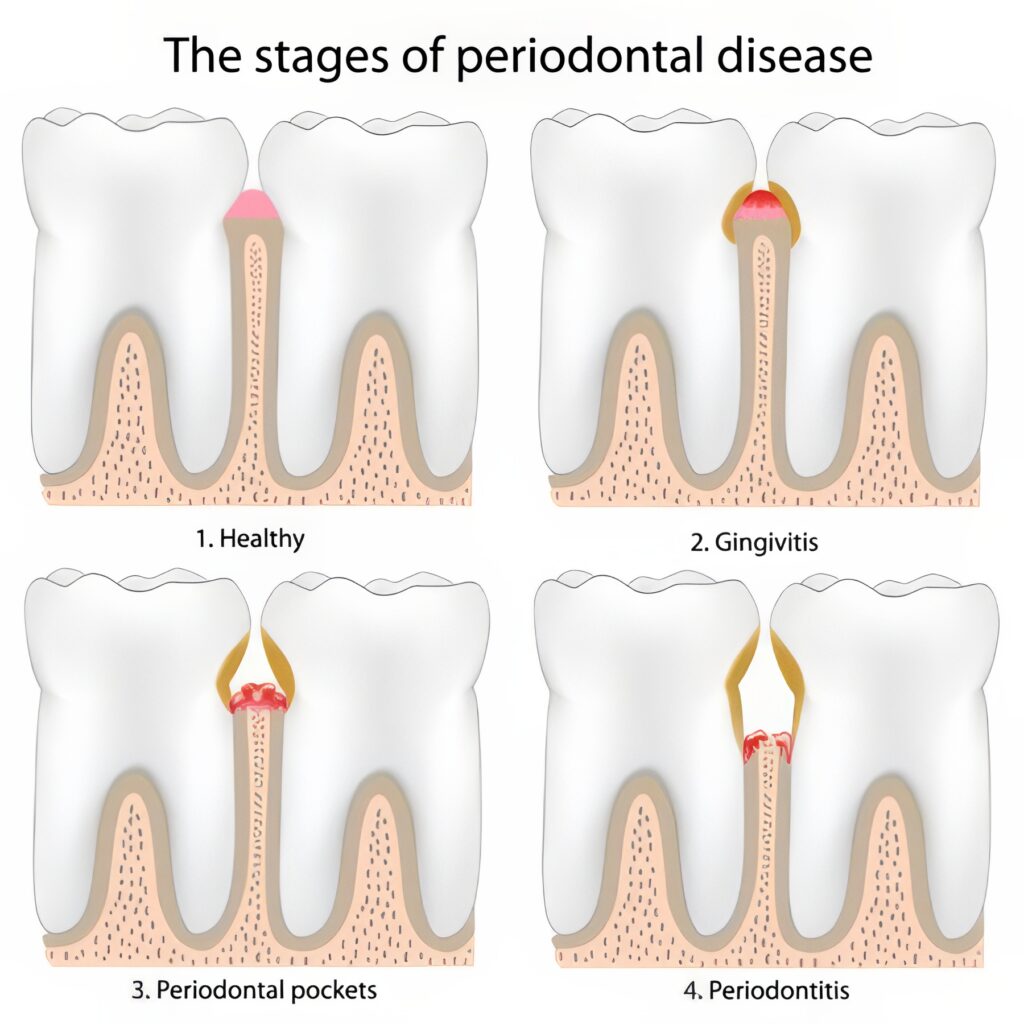 Periodontist-New-Fairfield-2-topaz-text-upscale-4x