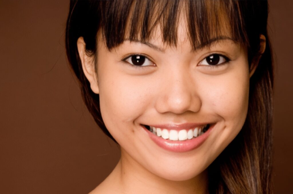 Veneers-Sherman-2-topaz-face-upscale-2x