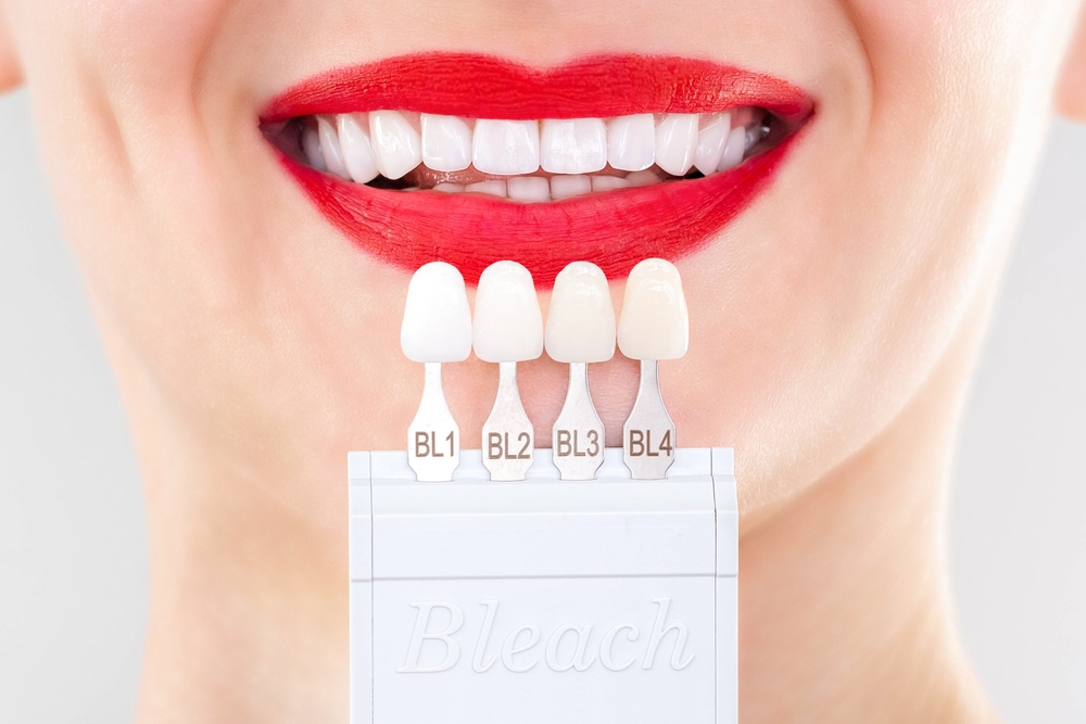 Perfect,White,Smile,Red,Lips,With,Shade,Guide,Bleach,Color
