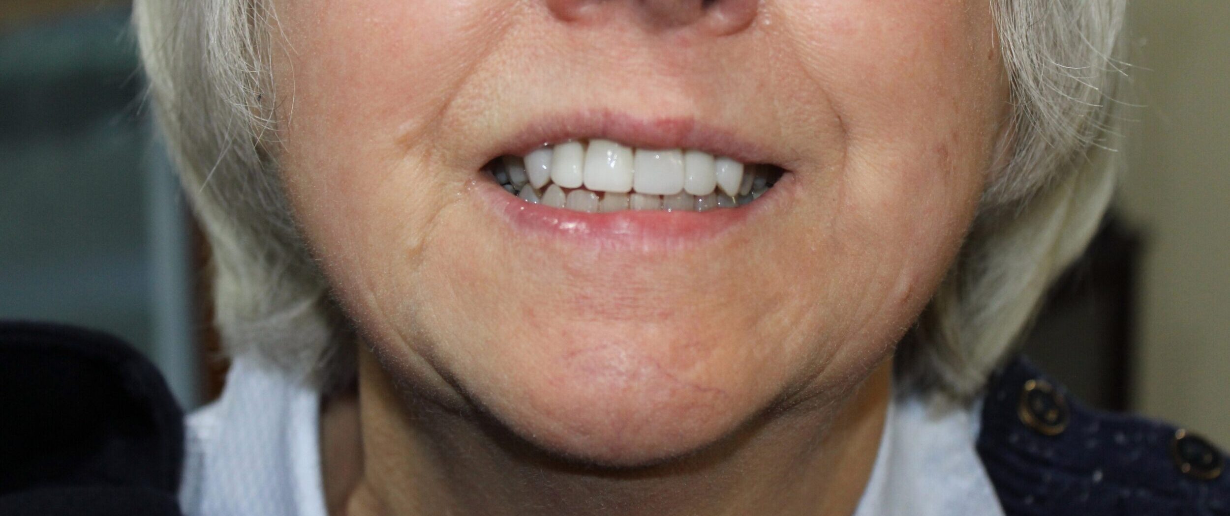 After Image: Lumineers - front