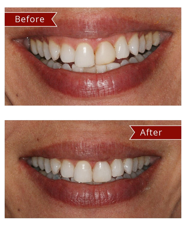 Before & After Gallery