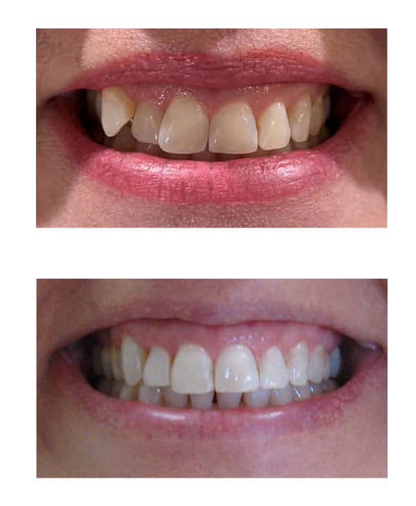 Before & After Gallery