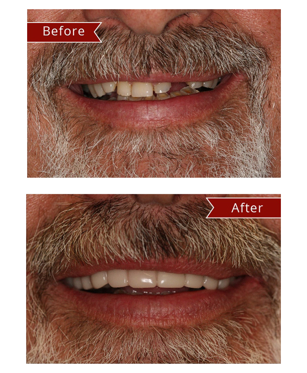 Before & After Gallery